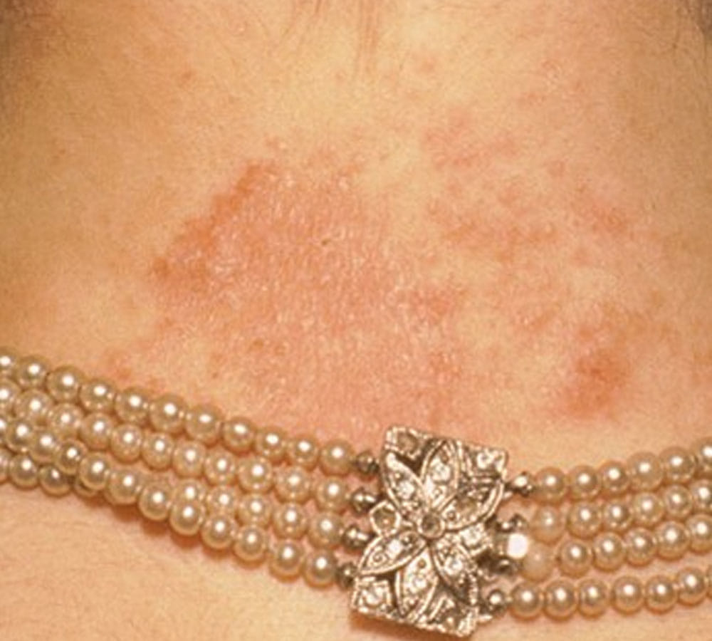 beauty benefits of tamarind scrub will blow your mind