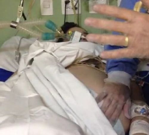 Brain dead women kept alive for 4 months gave birth   to twins in Brazil