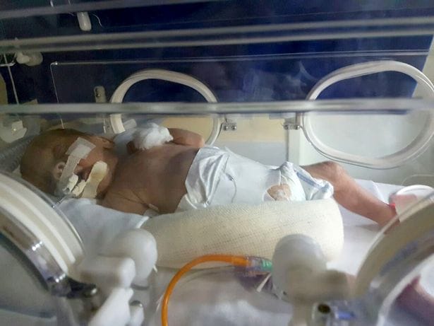 Brain dead women kept alive for 4 months gave birth   to twins in Brazil