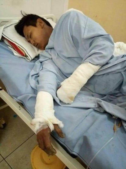 tibetan student died in delhi who burn self