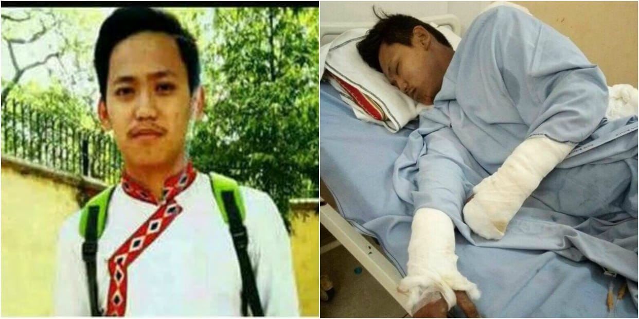 tibetan student died in delhi who burn self