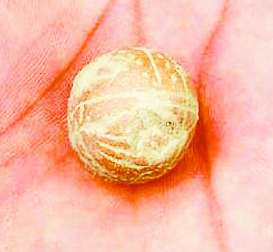 Excavation in Saktpur, found ancient culture