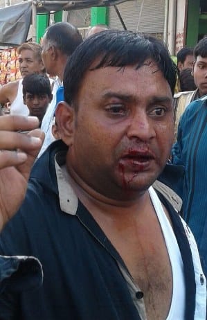 Four dealers injured in property dealer