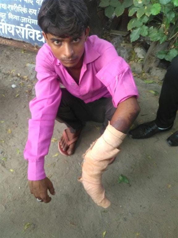  Toothache in Sikandrarao in hathras