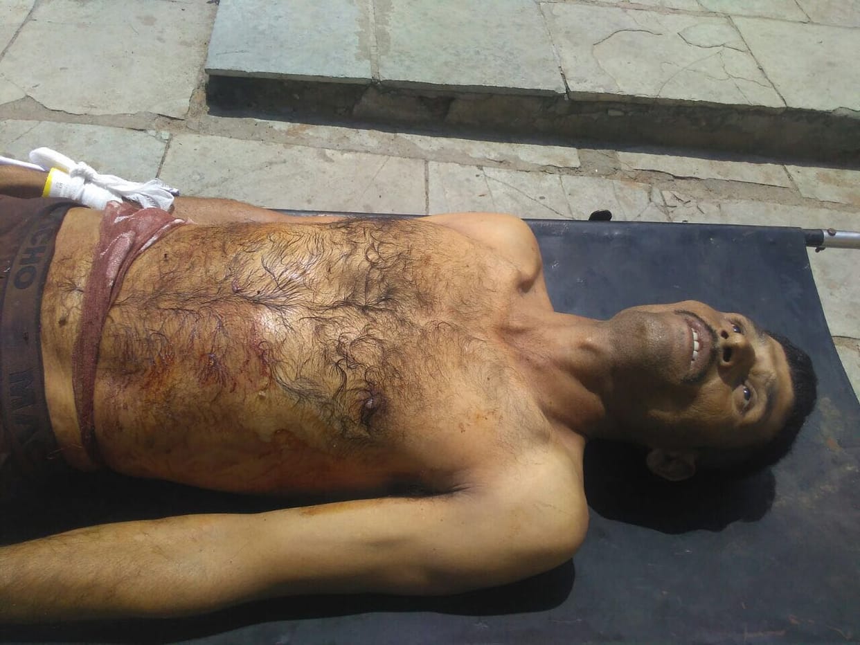  He was telling himself as a direct witness of Anandpur encounter, so the police shot