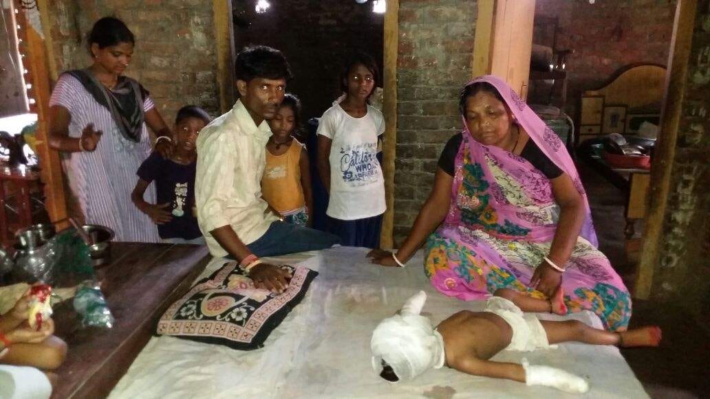 Fire broke out during a birthday party in Azamgarh, five injured 