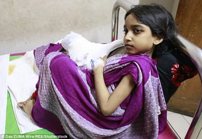 12 year bangladeshi girl battling with 'tree man' disease 