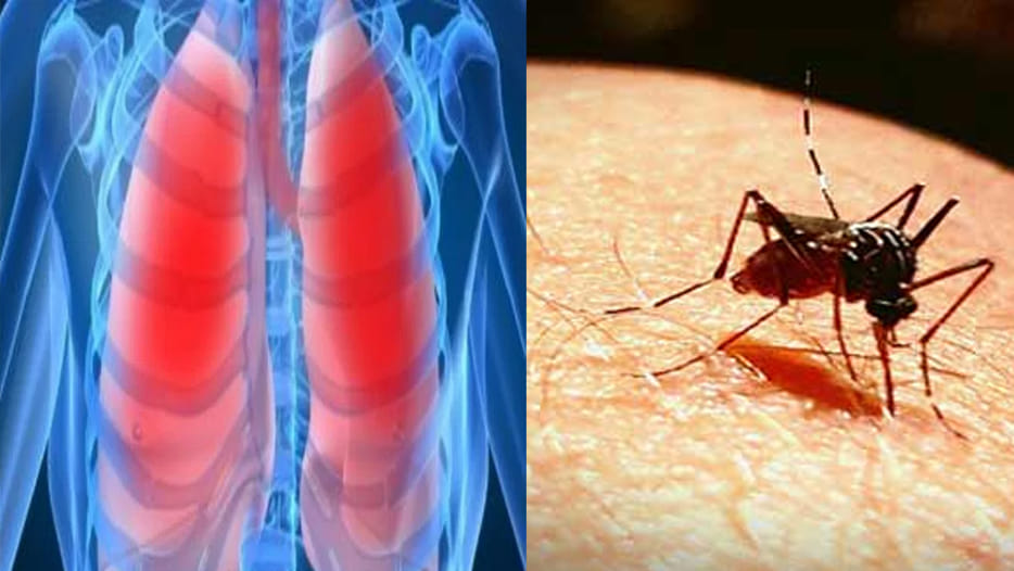 Infections on lungs cause malaria