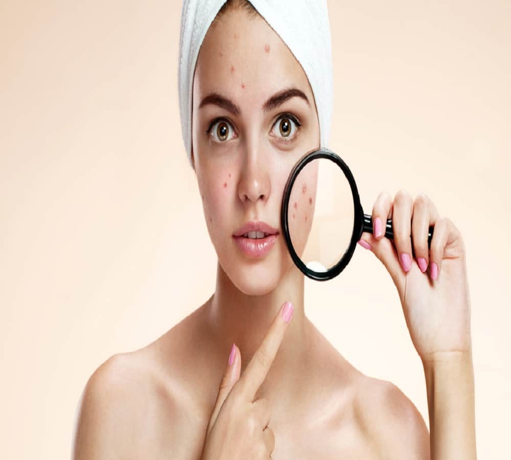 overeating of sugar can affect bad on your skin