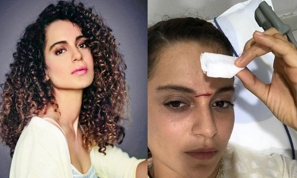 Kangana Ranaut Injured On The Set Of Manikarnika The Queen Of Jhansi, Rushed To Hospital