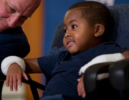  First double hand transplant declared success as first child patient