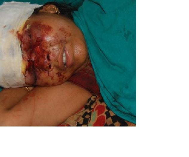 husband attacked wife for not including rice on the meal