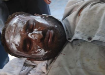 one killed in oxygen cylinder blast in rudrapur