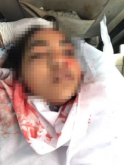 icg college girl died after falling from 6th floor of college 