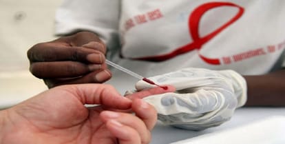 When we came to give blood, then 19 got HIV, if you do not have these symptoms in you!