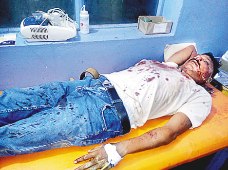 Jawariyas attacked police team, injured Durga