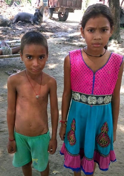 25 people sick of measles spread in search village