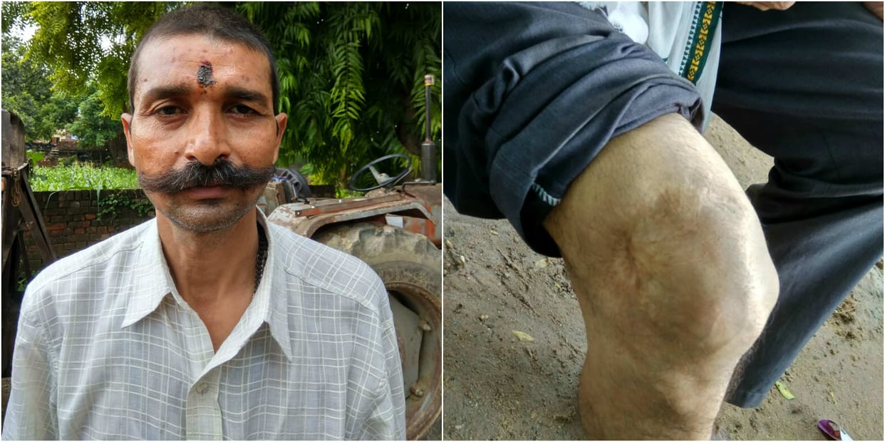 Kargil Vijay Diwas Eight bullets could not even break Aleem Ali Courage