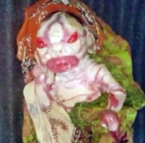 Harlequin-Type Ichthyosis is rare genetic disorder found in newly born babies