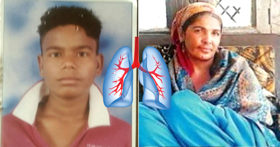 PGI's first lungs transplant is failed