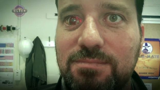  What does the person record by putting the camera in the eye