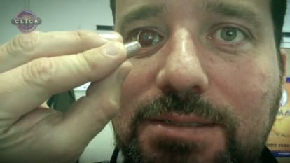  What does the person record by putting the camera in the eye