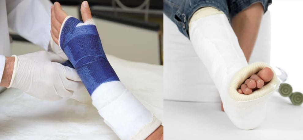 India USA scientists technique Biomaterial as bone graft substitute 