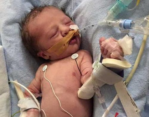 23 Week fetus undergoes heart operation in mothers womb at Toronto in Canada