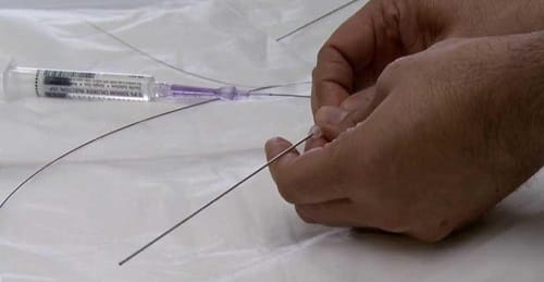 23 Week fetus undergoes heart operation in mothers womb at Toronto in Canada
