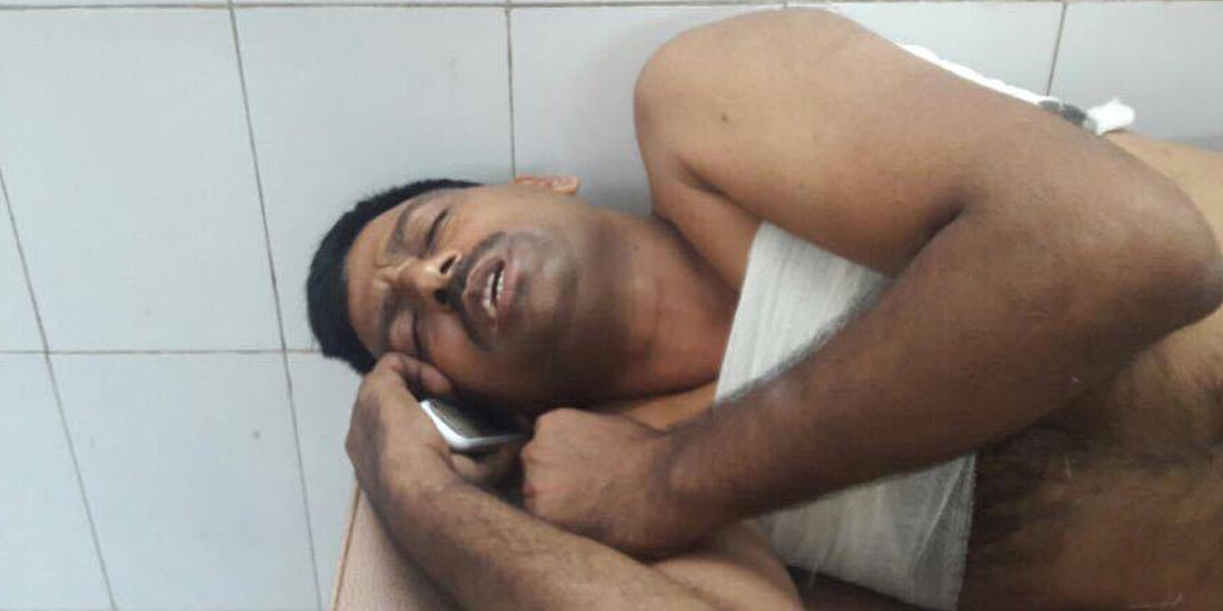 bank guard injured after gun shot at orai