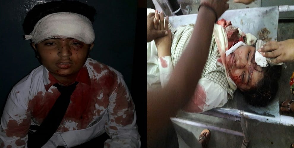DCM collided with the van, one killed, many children injured