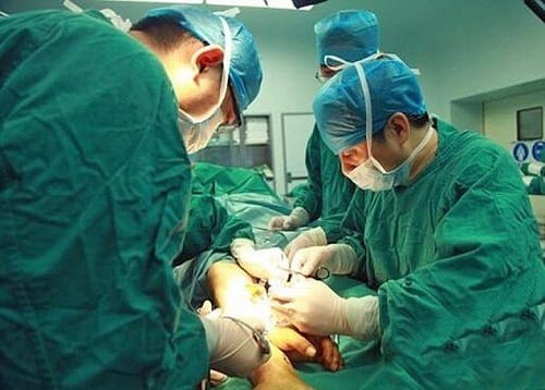 Man lost hands in accident doctor grafted it on leg