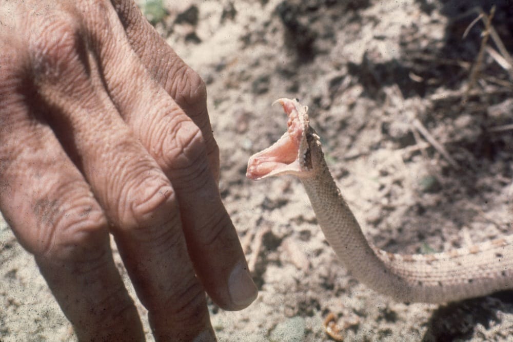 tips to survive after snake bite