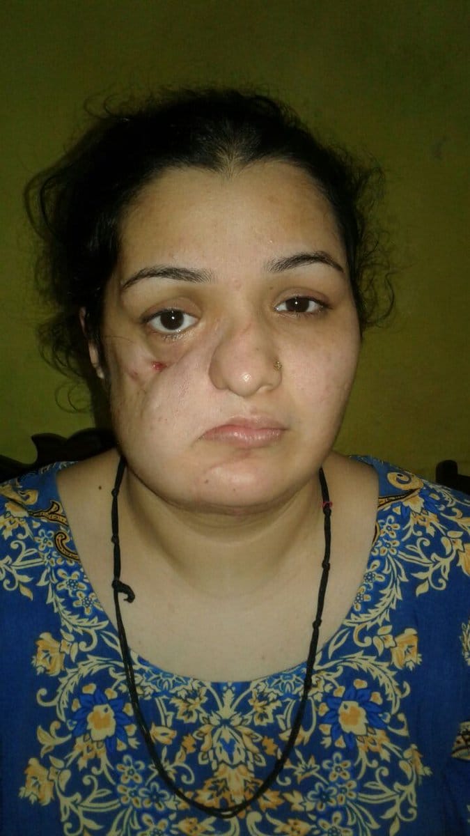 independence day 2017, sushma swaraj granted medical visa to pakistani girl faiza tanveer