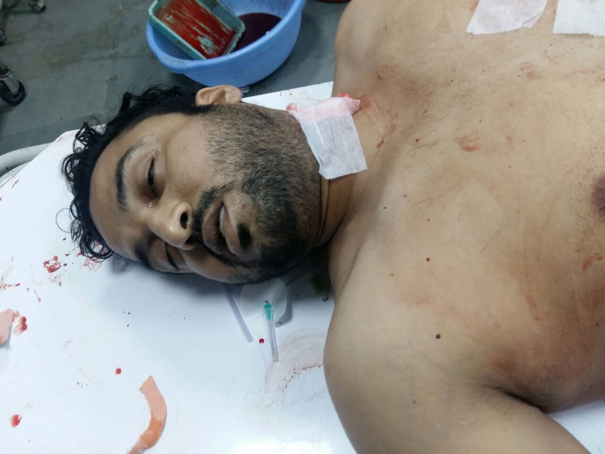 Firing in the Industrial Area, the young man shot dead