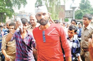 criminal burst fires, two  people injured