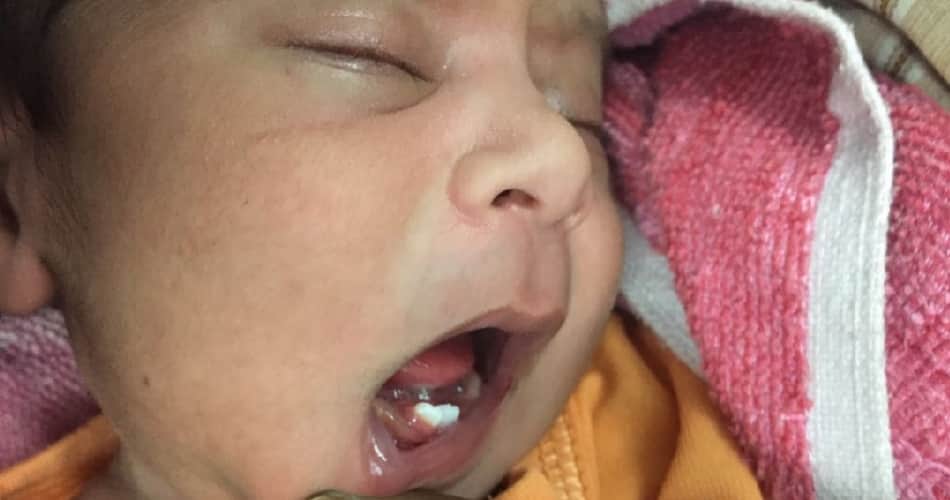 miracal of god, teeth in 16 days girl child mouth