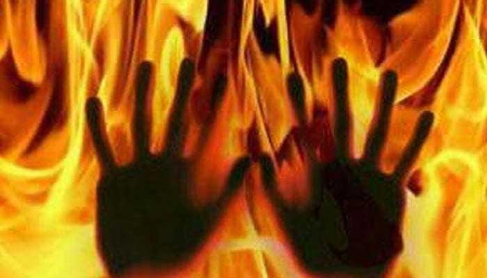 son his 70-year-old elderly father alived burns