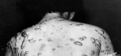 6 august, day when america bombed atomic bomb on hiroshima