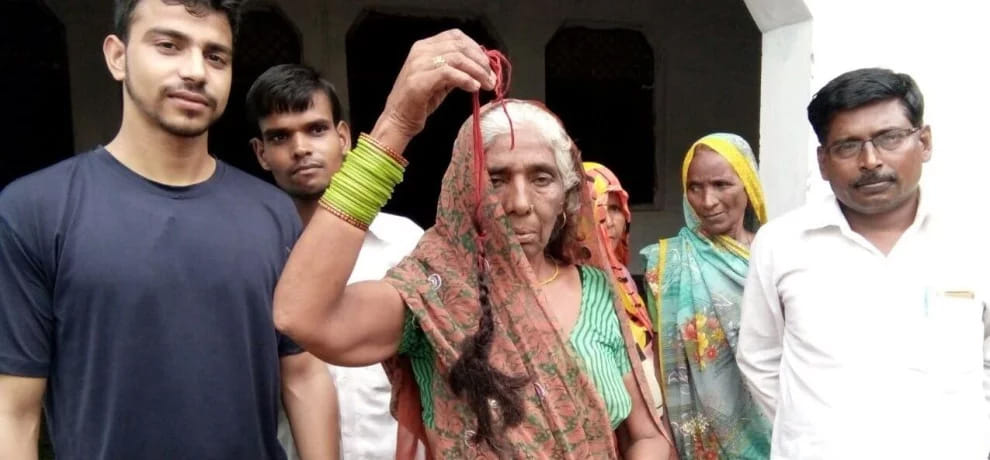 179 incidents of hair chopping