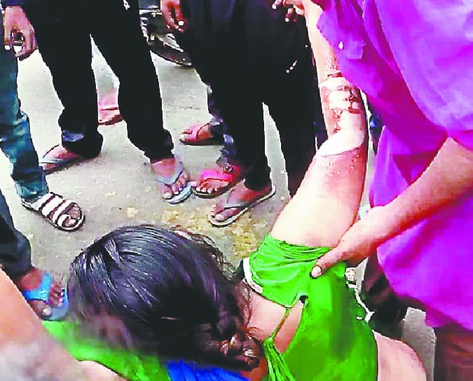 acid spread on lady