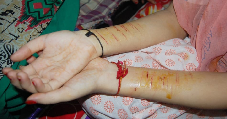 Hair Chopped Incident Happened In Haryana