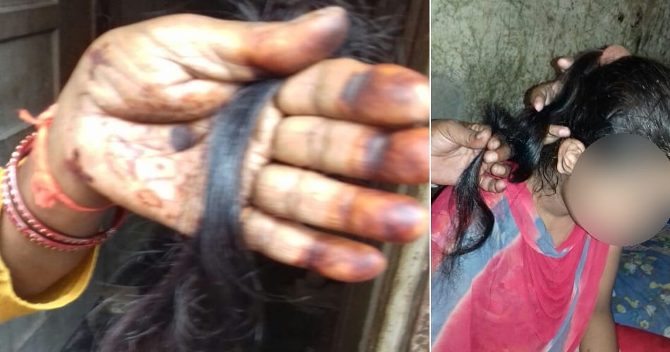 Hair Chopped Incident Happened In Chandigarh