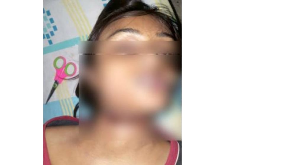engineer girl committed suicide after failed love in noida 
