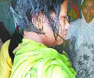 Three more rumours cases reported