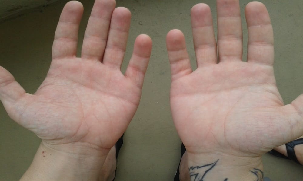 those person having these line in his palm become rich person