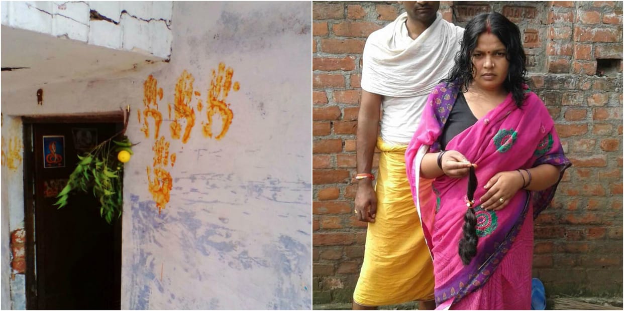 varanasi people applying these type of drips for avoid chotikatwa
