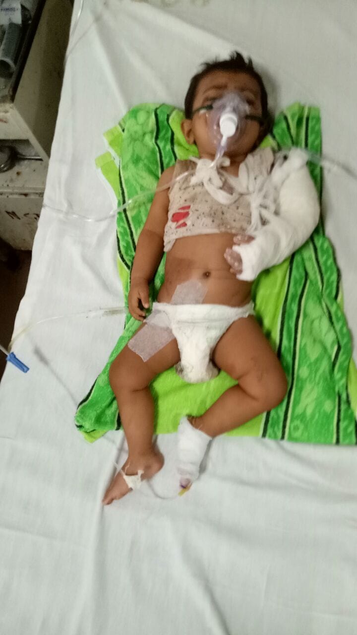 baby girl became orphan after accident in agra
