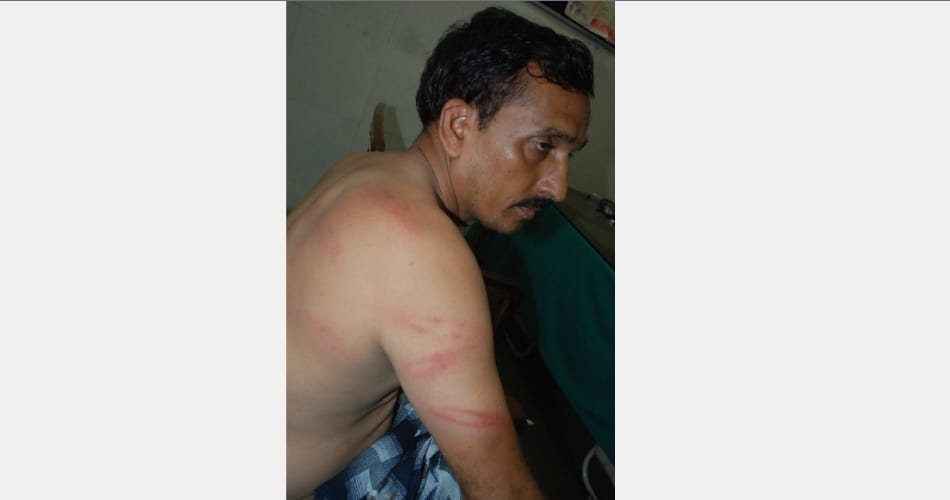 Attack on electricity workers, haryana news