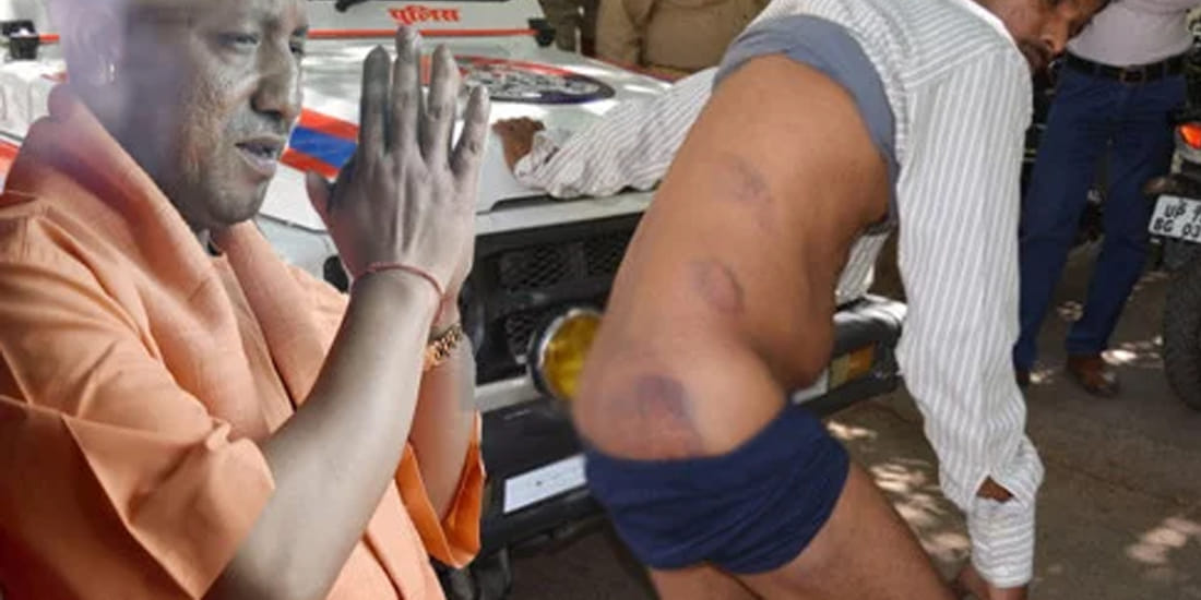 man beaten by police after complaining 